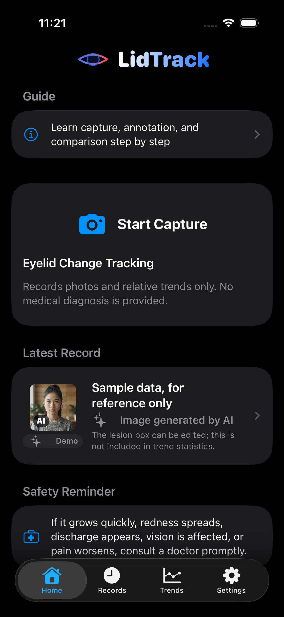 LidTrack home screen showing local records and relative change trends